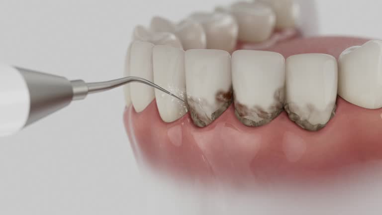 Trusted Teeth Cleaning And Checkup service in Hughestown, PA - Dentist Open Now